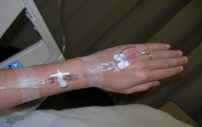 A female patient in a hospital room with an IV inserted into her hands, receiving IV therapy.